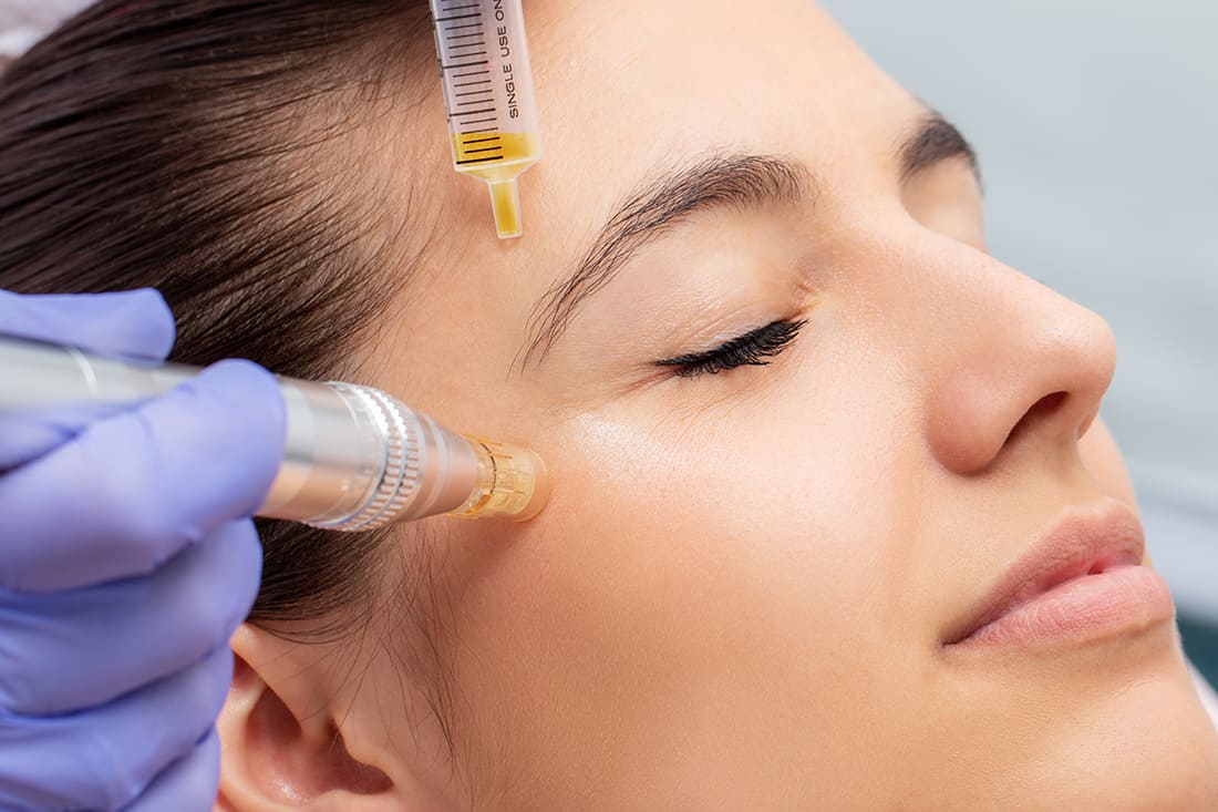 Should you try medspa micro-needling, skin renewal, anti-aging treatments in Lexington Kentucky (KY)