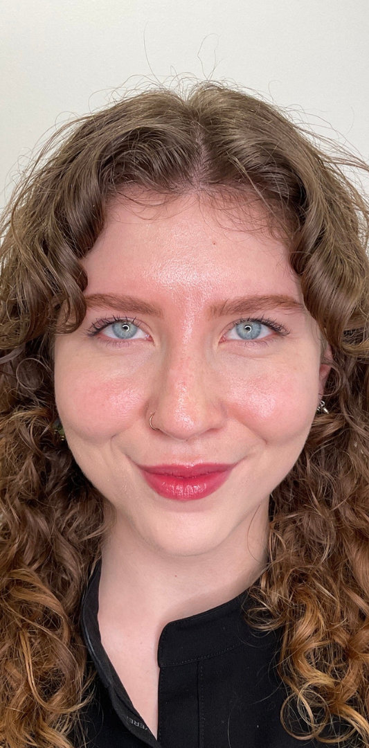 Botox Before & After Image
