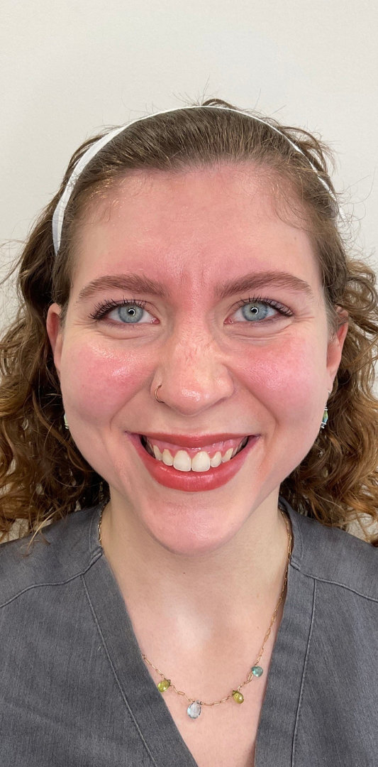 Botox Before & After Image